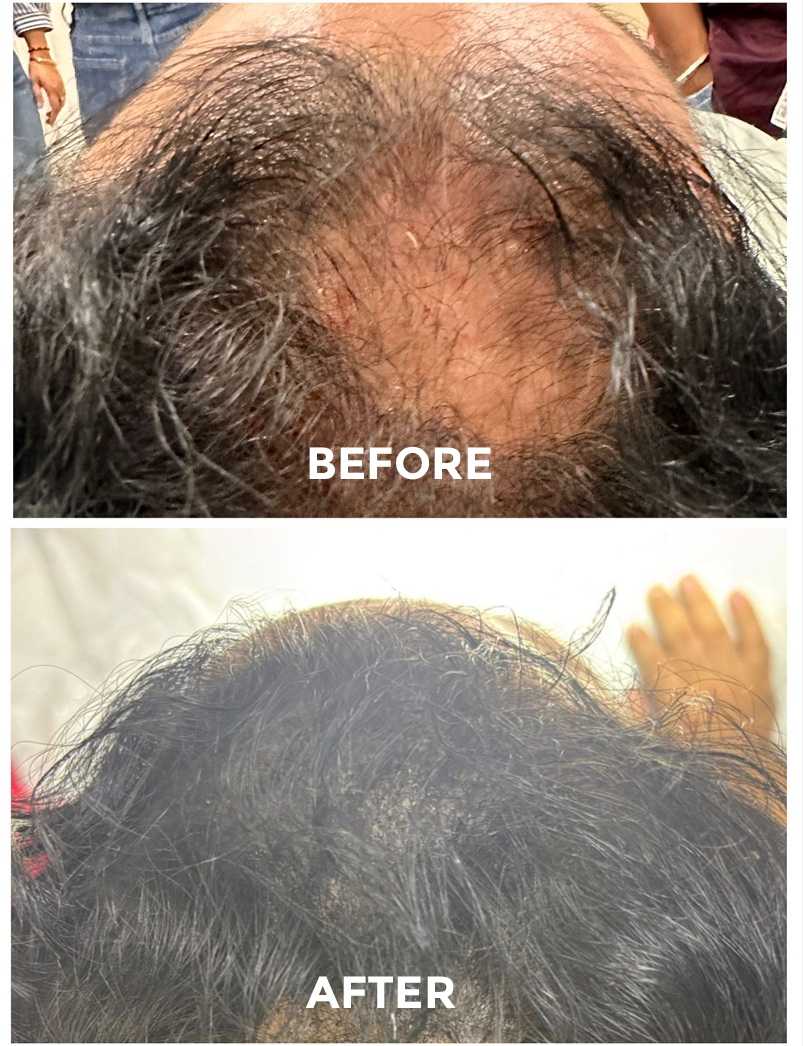 Master Course in Trichology